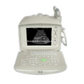 Cheapest wide application portable ultrasound machine/scanner price: Abdom, OB/GYN, Urology, Cardiology etc MSLPU04i